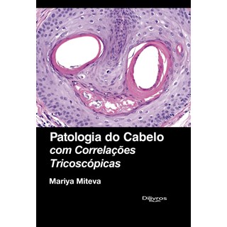 Livro - Patologia do Cabelo com Correlacoes Tricoscópicas - Miteva