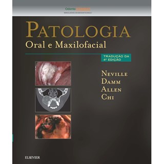 Livro - Patologia Oral e Maxilofacial - Neville