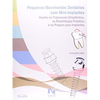 Livro - Pequenos Movimentos Dentarios com Mini-implantes - Auxilio No Tratamento or - Park