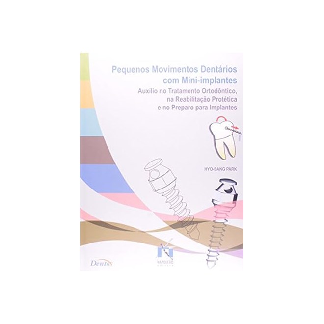 Livro Pequenos Movimentos Dentários com Mini-implantes - Park -  Napoleão