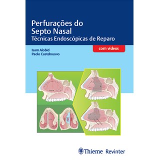 Livro - Perfuracoes do Septo Nasal - Tecnicas Endoscopicas de Reparo - Alobid/castelnuovo
