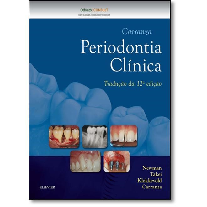 livro carranza periodontia