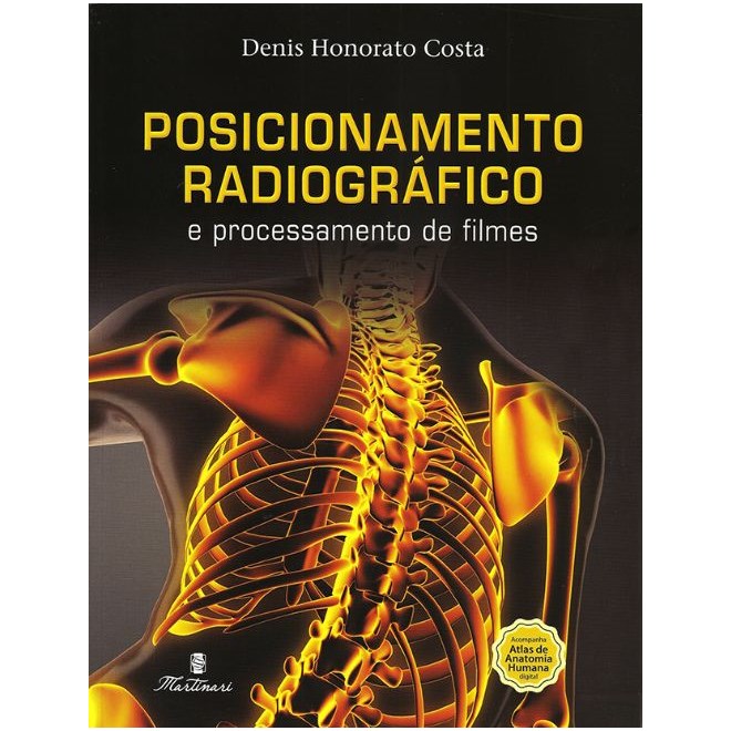Livro Posicionamento Radiográfico e Processamento de Filmes - Costa - Martinari