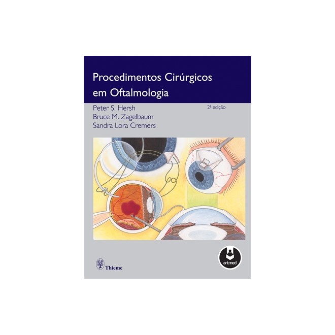 Livro - Procedimentos Cirurgicos em Oftalmologia - Hersh/zagelbaum/crem