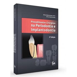 Livro Procedimentos Cirúrgicos na Periodontia e Implantodontia - Novaes - Santos Publicações