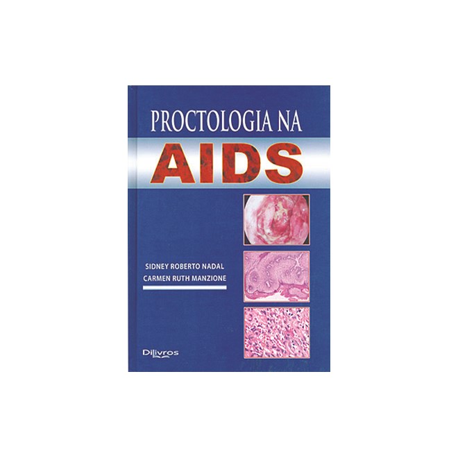 Livro Proctologia na AIDS - Nadal - Dilivros