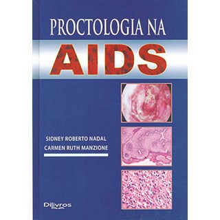 Livro Proctologia na AIDS - Nadal - Dilivros