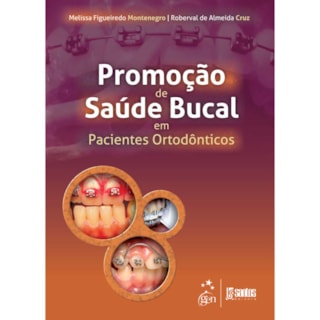 Livro - Promoção de Saúde Bucal em Pacientes Ortodônticos - Montenegro Livro - Promoção de Saúde Bucal em Pacientes Ortodônticos - Montenegro