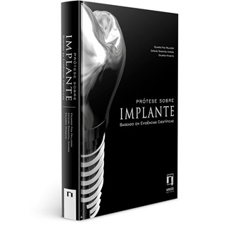 Livro - Protese sobre Implante - Baseado em Evidencias Cientificas - Miyashita/pellizzer