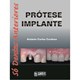Livro - Prótese sobre Implante: Só Dentes Anteriores - Cardoso