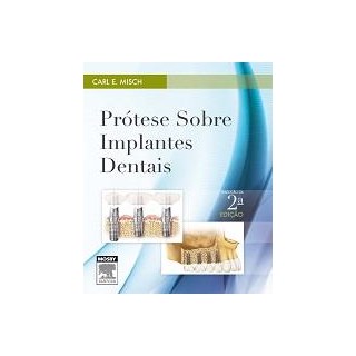 Livro - Prótese sobre Implantes Dentais - Misch