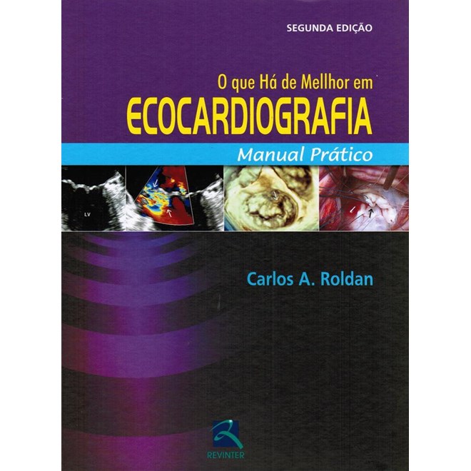 Livro - Que Ha de Melhor em Ecocardiograma, O - Roldan