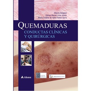 Livro - Queimaduras - Conductas Clinicas Y Quirurgicas - Bolgiani/lima Junior