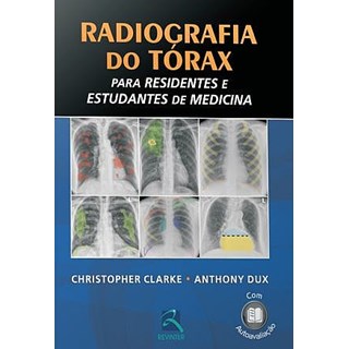 Livro - Radiografia do Torax para Residentes e Estudantes *** - Clarke/ Dux