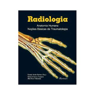 Livro Radiologia - Anatomia Humana Noções Básicas de Traumatologia - Santos - Martinari