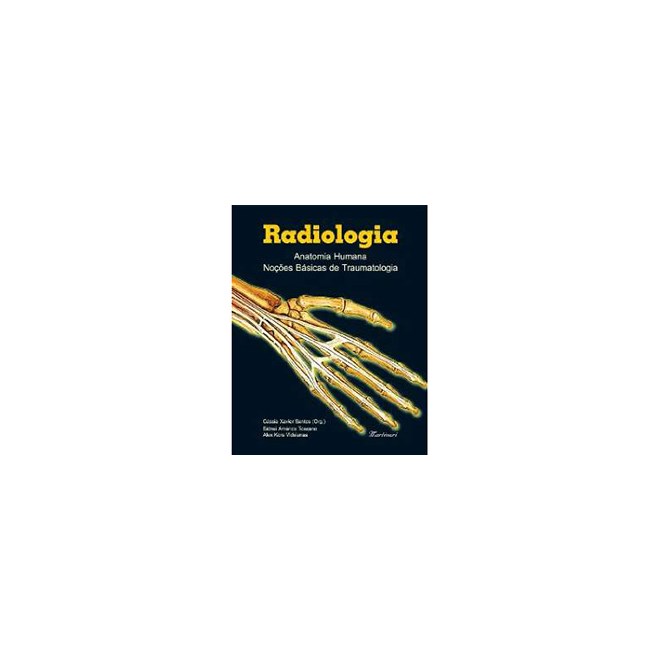 Livro Radiologia - Anatomia Humana Noções Básicas de Traumatologia - Santos - Martinari