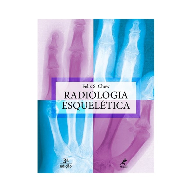 Livro - Radiologia Esqueletica *** - Chew