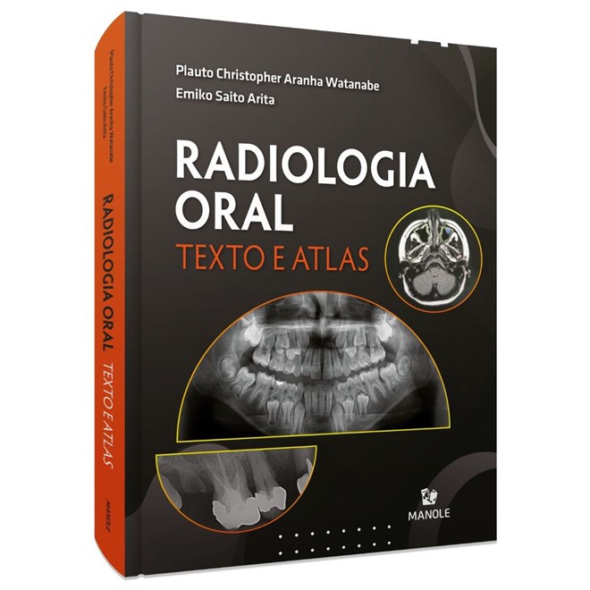 Livro - Radiologia Oral: Texto e Atlas - Watanabe - Manole