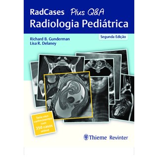 Livro - Radiologia Pediatrica: Radcases + Q&a - Gunderman/delaney