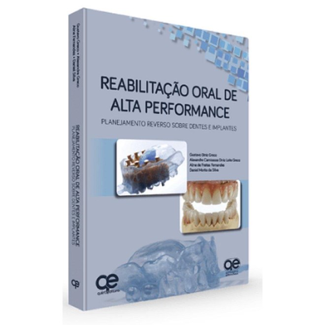 Livro - Reabilitação Oral de Alta Performance: Planejamento Reverso sobre Dentes e Implantes - Greco - Santos