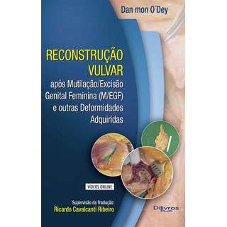 Livro Reconstrução Vulvar - O'Dey - Dilivros
