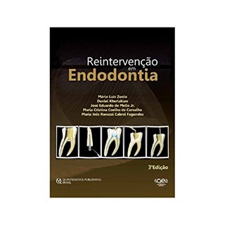 Livro - Reintervenção em Endodontia - Zuolo - Santos