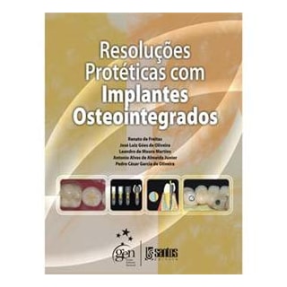 Livro - Resoluções Protéticas com Implantes Osteointegrados - Freitas Livro - Resoluções Protéticas com Implantes Osteointegrados - Freitas
