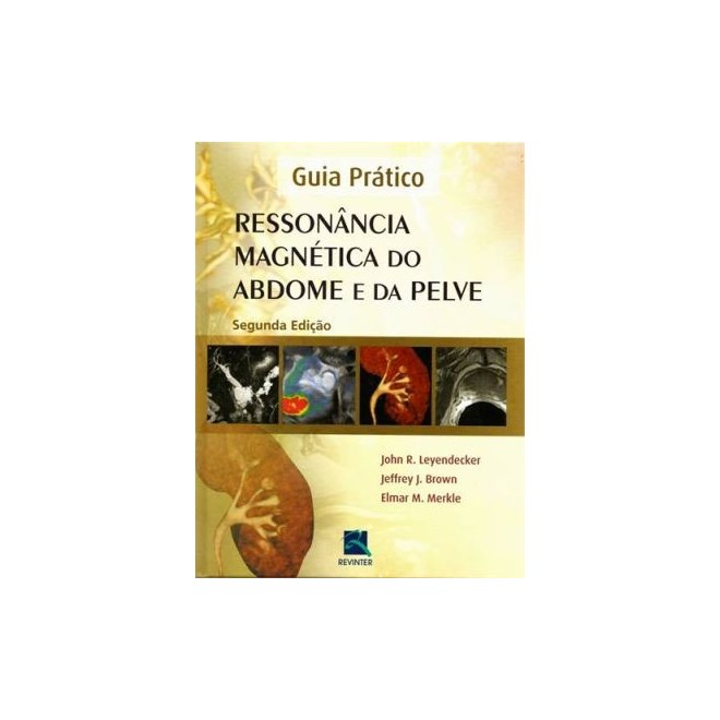 Livro - Ressonancia Magnetica do Abdome e da Pelve - Leyendecker/brown