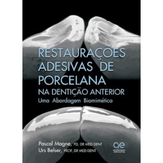 Livro - Restaurações Adesivas de Porcelana na Dentição Anterior - Magne Livro - Restaurações Adesivas de Porcelana na Dentição Anterior - Magne
