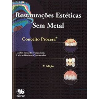 Livro - Restauracoes Esteticas sem Metal - Francischone/vasconc
