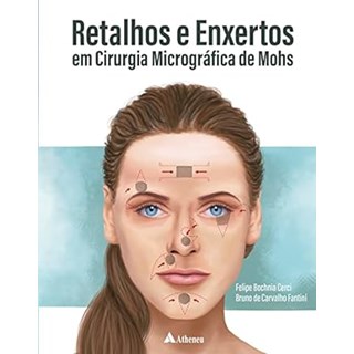 Livro - Retalhos e Enxertos em Cirurgia Micrografica de Mohs - Cerci - Atheneu