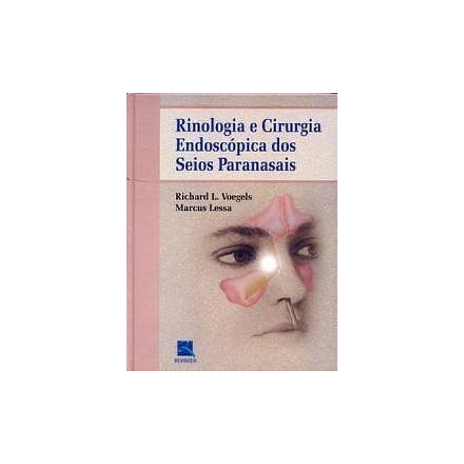 Livro - Rinologia e Cirurgia Endoscopica dos Seios Paranasais - Voegels/lessa