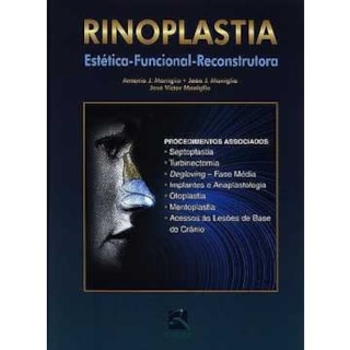 Livro - Rinoplastia - Estética - Funcional - Reconstrutora - Maniglia Livro - Rinoplastia - Estética - Funcional - Reconstrutora - Maniglia