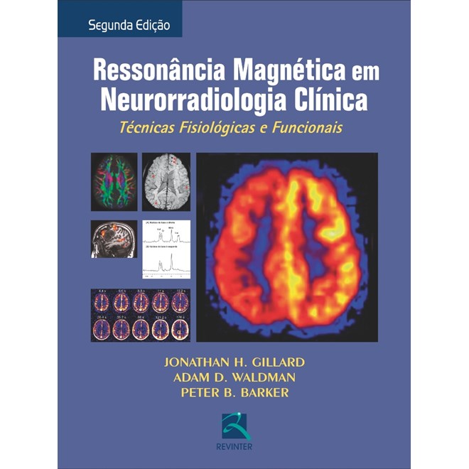 Livro - Rm em Neurorradiologia Clinica *** - Gillard