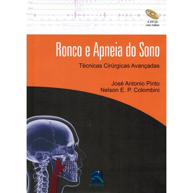 Livro - Ronco e Apneia do Sono: Tecnicas Cirurgicas Avancadas - Pinto/colombini