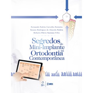 Livro - Segredos do Mini-implante na Ortodontia Contemporânea - Pedrin