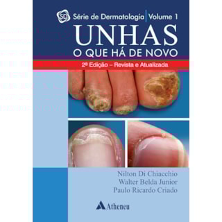 Livro - Série Dermatologia - Unhas o Que Há de Novo - Vol 1 - Chiacchio Livro - Série Dermatologia - Unhas o Que Há de Novo - Vol 1 - Chiacchio