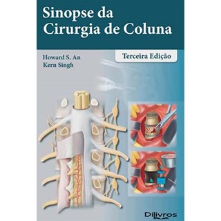 Livro - Sinopse da Cirurgia de Coluna - An/singh