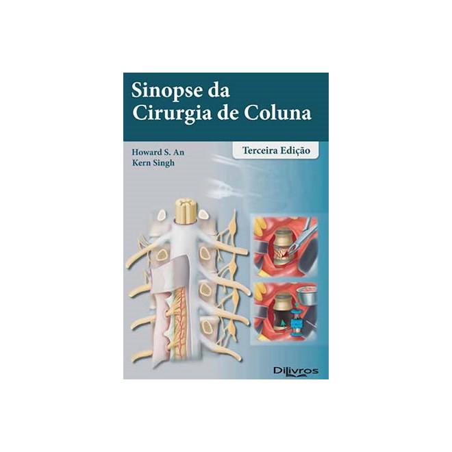 Livro Sinopse da Cirurgia de Coluna - An/singh- Dilivros