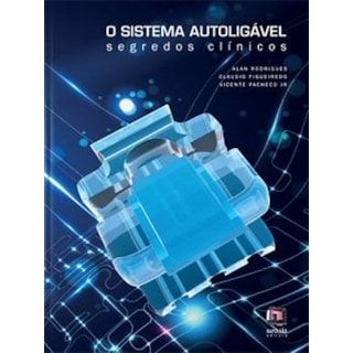 Livro - Sistema Autoligável - Segredos Clínicos - Rodrigues Livro - Sistema Autoligável - Segredos Clínicos - Rodrigues