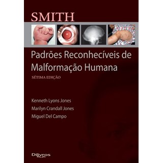 Livro - Smith Padrões Reconheciveis de Malformação Humana - Jones