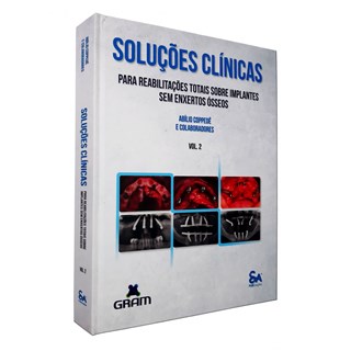 Livro Soluções Clínicas para Reabilitações Totais sobre Implantes sem Enxertos Ósseos - Santos Pub