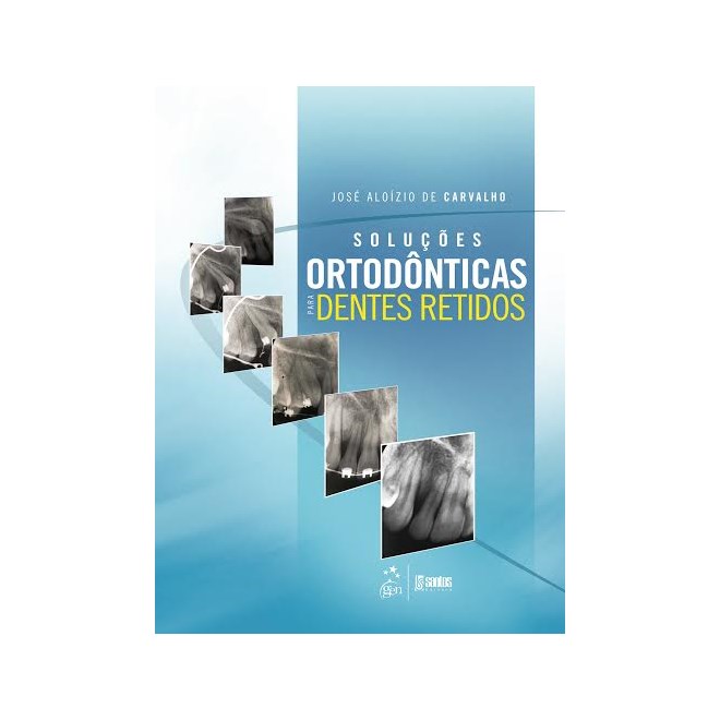 Livro - Soluções Ortodônticas para Dentes Retidos - Carvalho