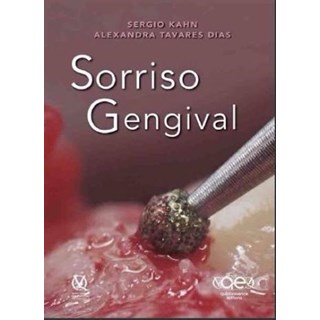 Livro - Sorriso Gengival - Kahn - Santos