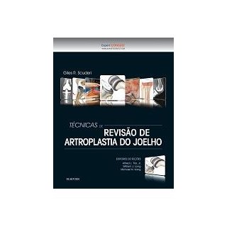 Livro - Tecnicas de Revisao de Artroplastia do Joelho - Scuderi