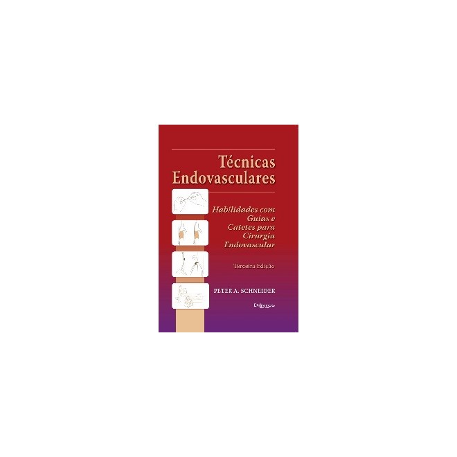 Livro - Tecnicas Endovasculares - Schneider