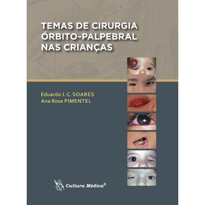 Livro - Temas de Cirurgia Orbito-palpebral Nas Criancas - Soares