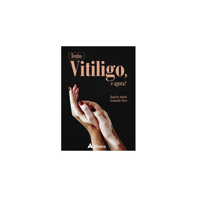 Livro - Tenho Vitiligo, e Agora - Alves - Atheneu