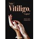Livro - Tenho Vitiligo, e Agora - Alves - Atheneu