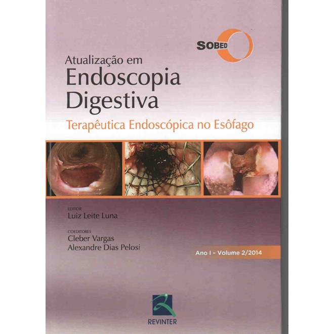 Livro - Terapeutica Endoscopica No Esofago Vol. 2 - Sobed/luna